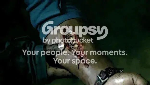 Una herida en un brazo que deja ver piel de reptil, tapada por el aviso de Photobucket